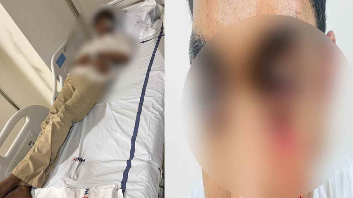 ദഫ്മുട്ട് പരിശീലനത്തിനിടെ തര്‍ക്കം; പ്ലസ് വൺ വിദ്യാർത്ഥിക്ക് മർദനമേറ്റു