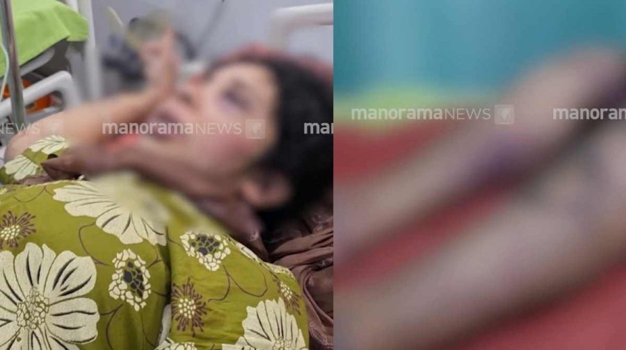 thamarassery-pregnant-women