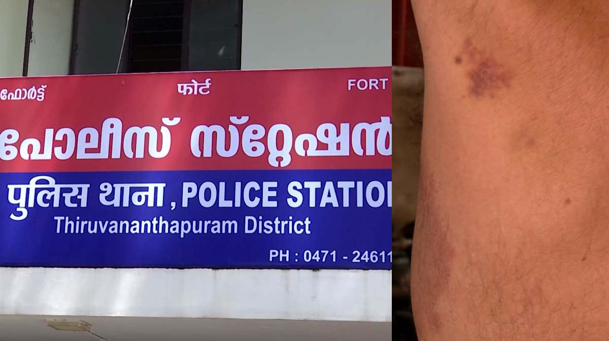 fort-police-station-custodian-torture