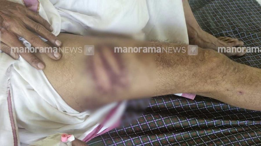 auto-driver-alleges-police-brutality