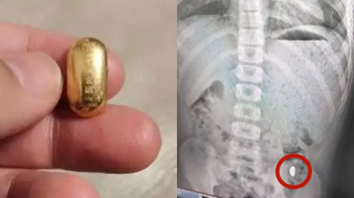 Image credit: sin chew daily 