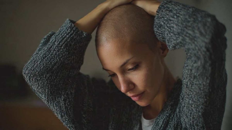 hair-loss-news-divorce