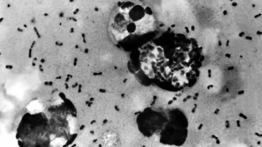 Image Credit: Centers for Disease Control and Prevention