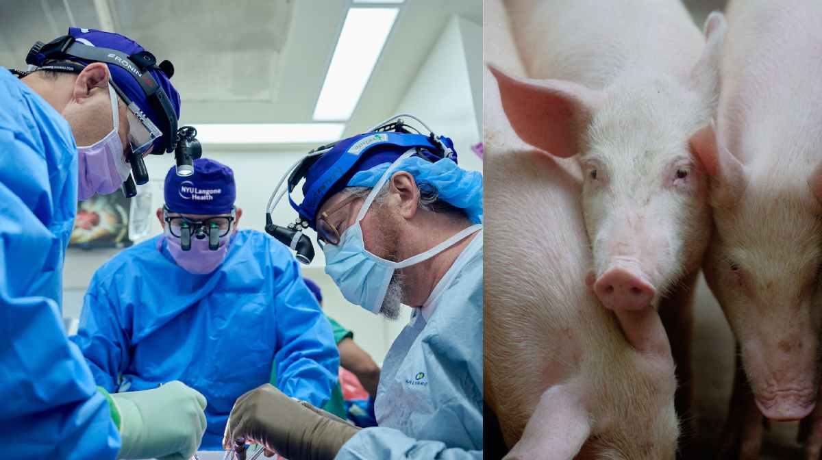 xenotransplantation