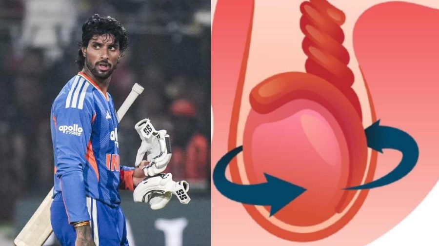 testicular-torsion-tilak-varma-n