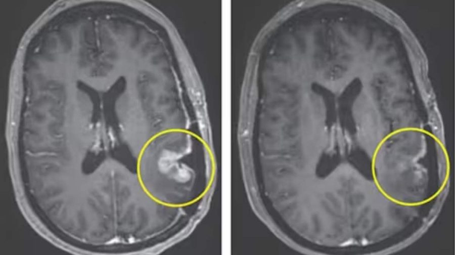 Image Credit: The New England Journal of Medicine