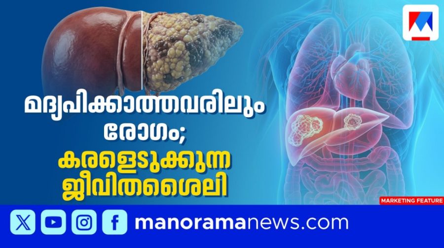 Liver-Marketing-HD1904