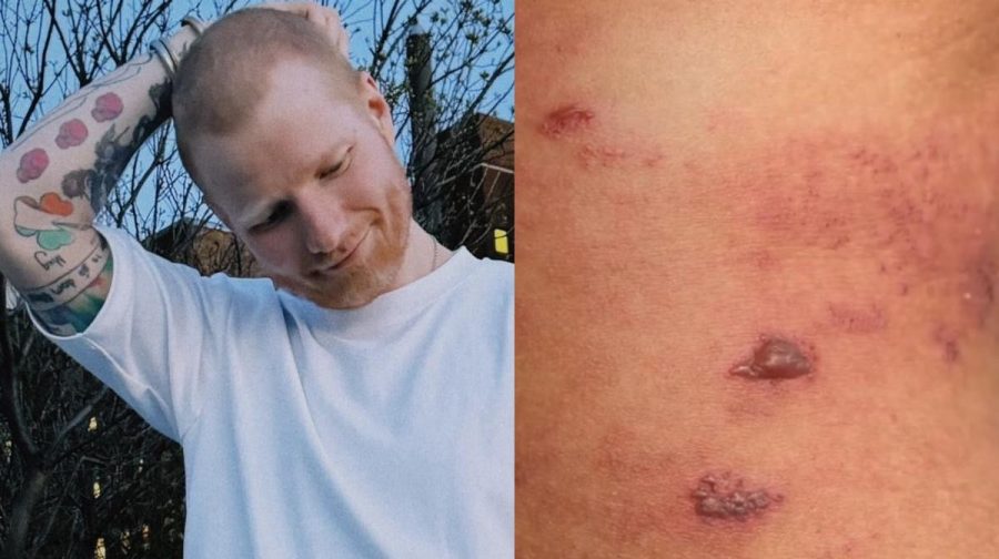 sheeran-shingles