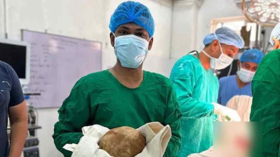 doctors-claim-to-remove-massive-three-kg-bladder-stone-removal