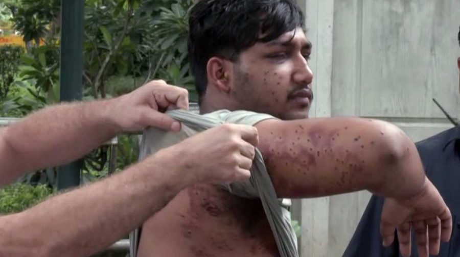 pellet-gun-attack-cjp