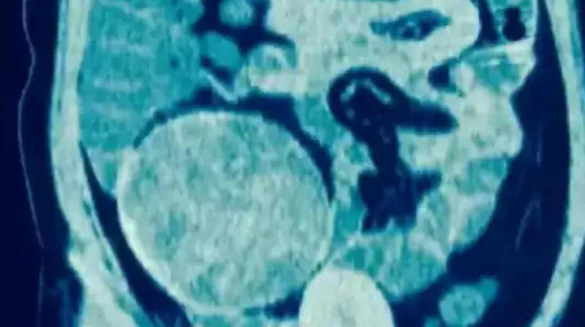 Image Credit: Livescience.com