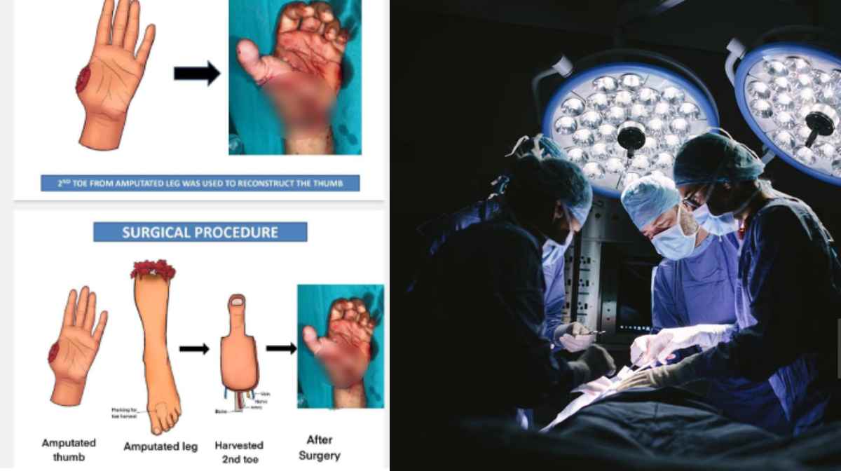 fingure-surgery