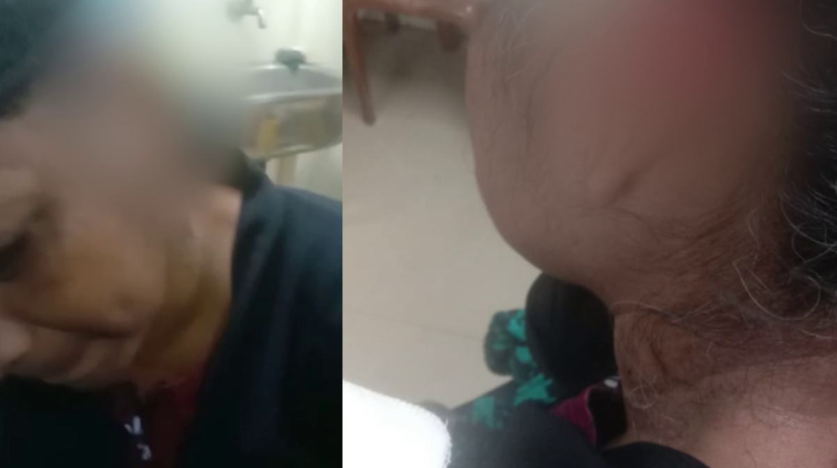 ഗുരുവായൂരില്‍ തെരുവുനായ വീട്ടമ്മയുടെ ചെവി കടിച്ചെടുത്തു; ആക്രമണം വീട്ടുമുറ്റത്ത് പുല്ല് പറിക്കുന്നതിനിടെ