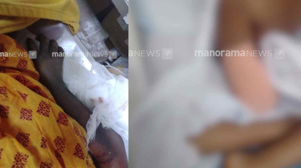 palakkad-hospital-negligence-child-loses-arm
