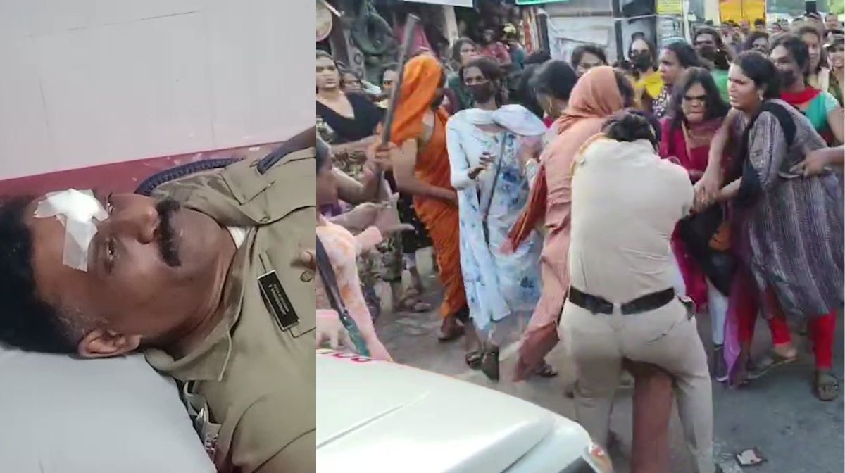 Donated kidneys, corneas, and liver - 1