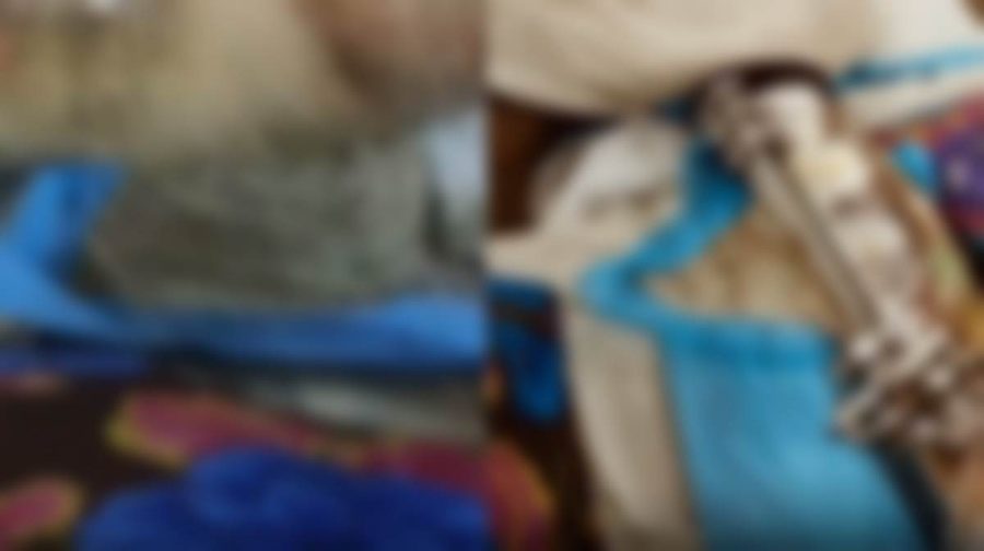 തിരു. മെഡിക്കല്‍ കോളജില്‍ രോഗി പുഴുവരിച്ച നിലയില്‍