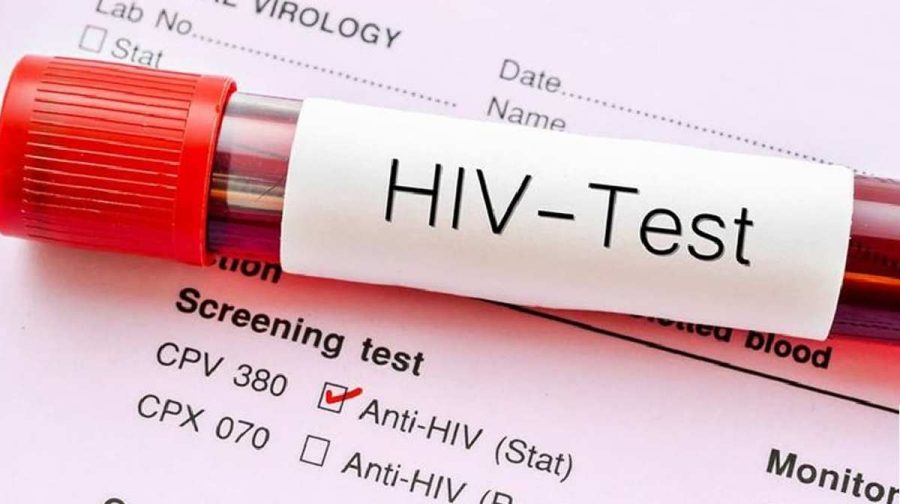 hiv-test