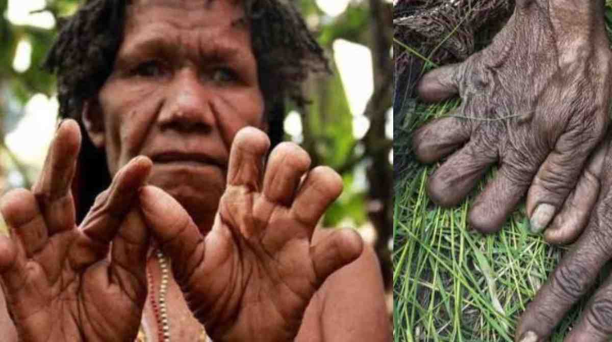 dani-tribe-finger-cutting-ritual