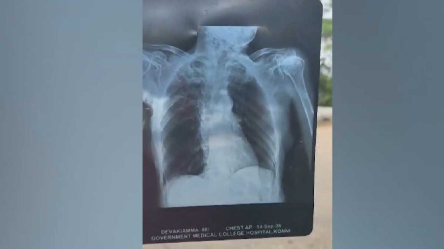 x-ray