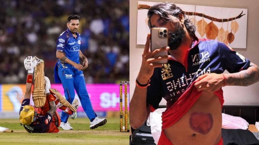 krunal-pandya-reveals-scar