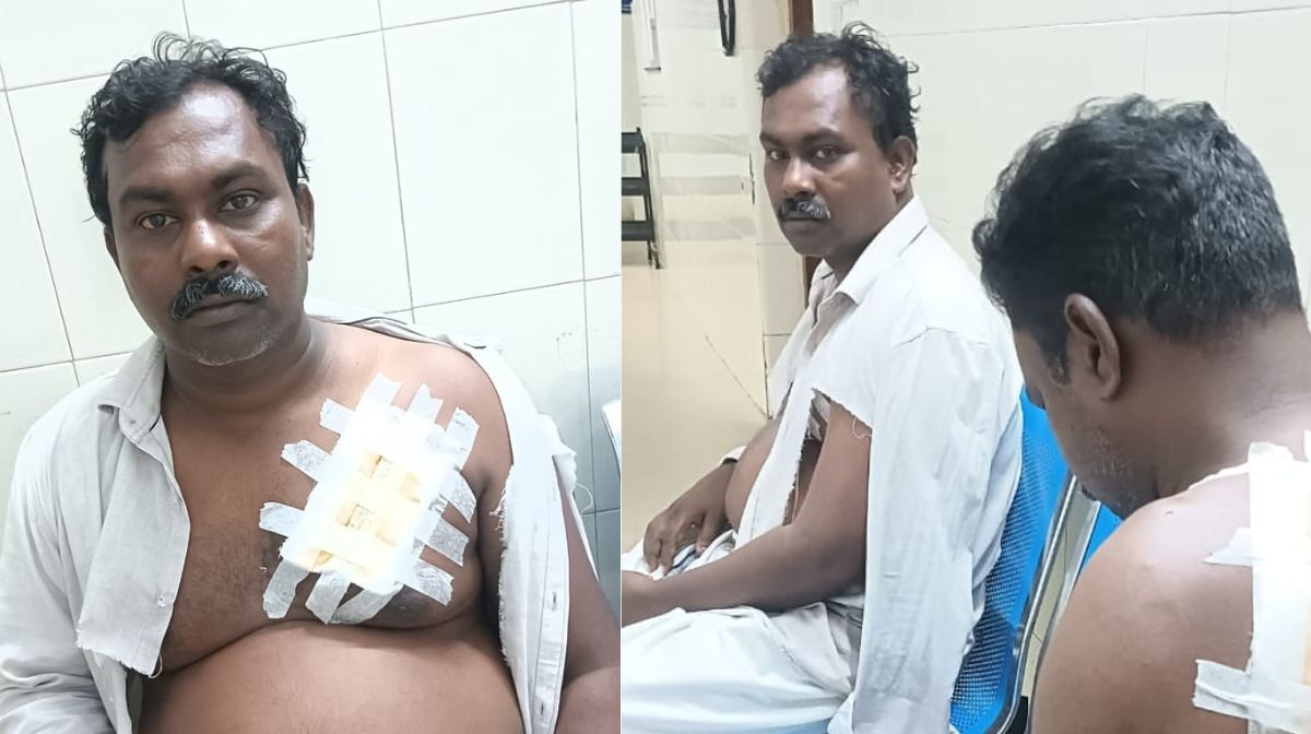 Donated kidneys, corneas, and liver - 1