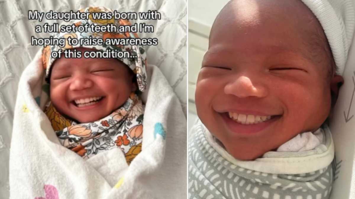 child-born-with-teeth