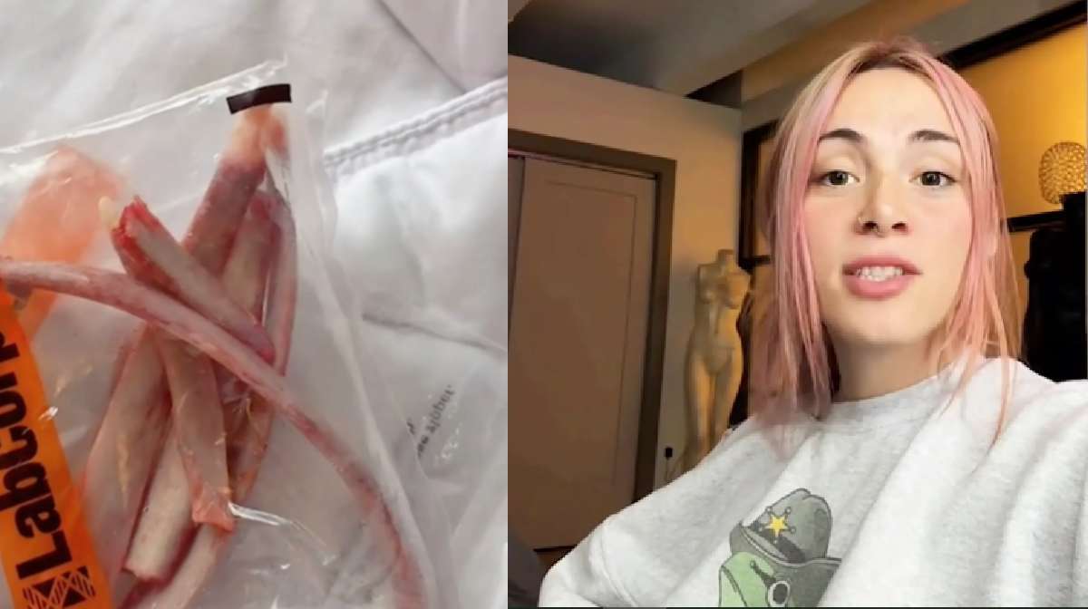 image: Emily James / CATERS NEWS