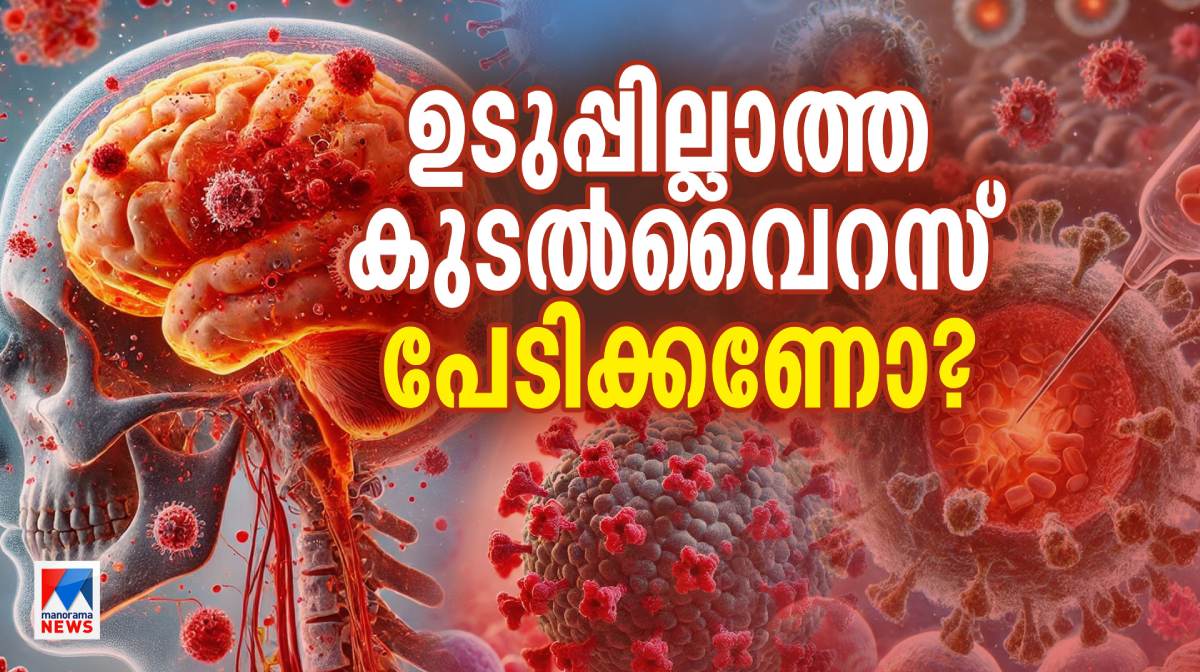 viral-meningitis