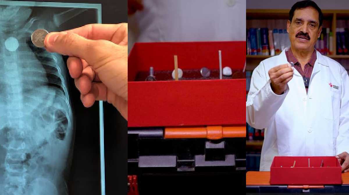 child-swallowing-object-first-aid-rajagiri-hospital-video