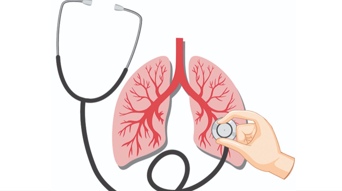 lung-cancer