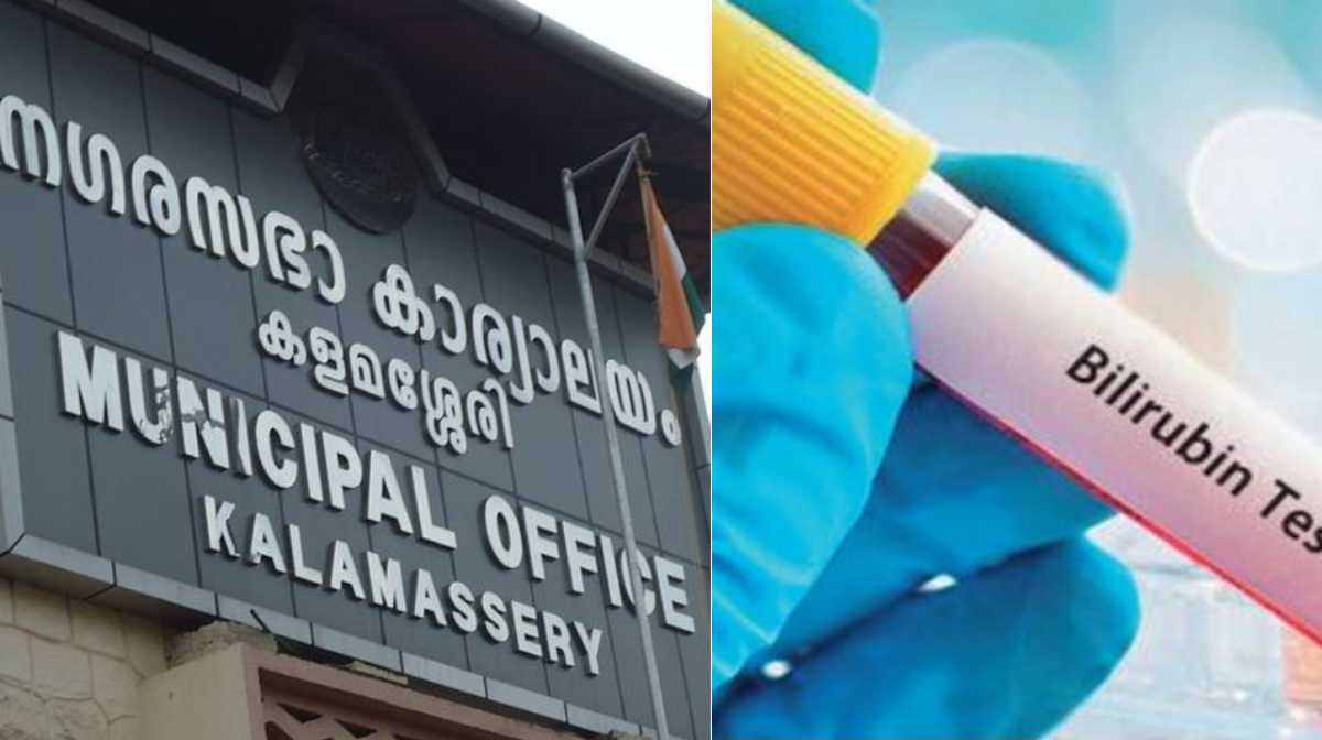 jaundice-spreads-in-kalamasseri-municipality