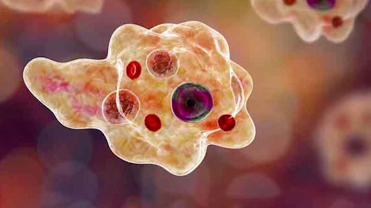 amoebic-fever