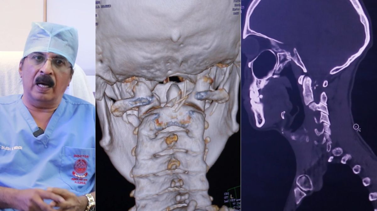 ഹോമിയോയെയും ആയുര്‍വേദത്തെയും തഴഞ്ഞതെന്തിന്? സര്‍ക്കാരിനെതിരെ ഡോ. ബിജു പൊതുജനാരോഗ്യ നിയമത്തിൽ കാലാനുസൃത മാറ്റങ്ങള്‍ വരുത്തി വ്യവസ്ഥ രൂപീകരിക്കാനായി രൂപീകരിച്ച ആരോഗ്യ വകുപ്പിന്‍റെ പ്രത്യേക സമിതിയില്‍ നിന്ന് ഹോമിയോ, ആയുര്‍വേദം എന്നിവയെ തഴഞ്ഞതിനെതിരെ - 1