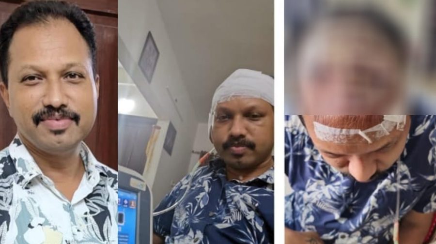 hair-transplantation