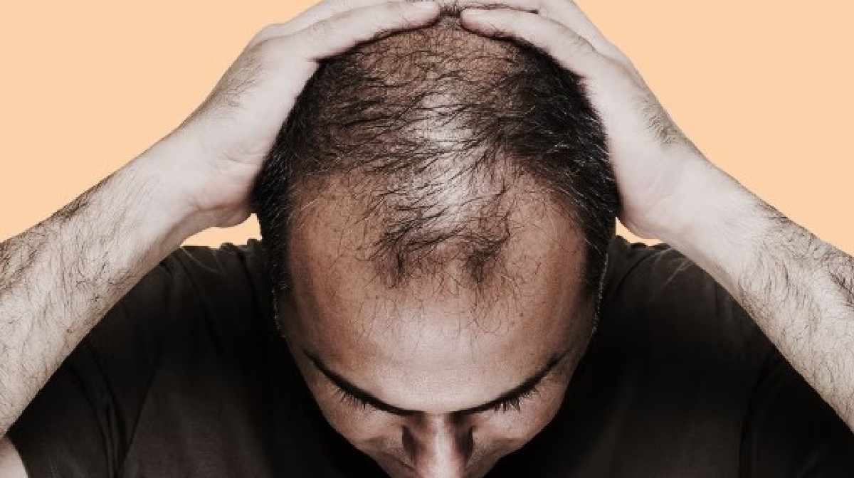 how-to-reduce-hairfall-naturallay-home-remedies