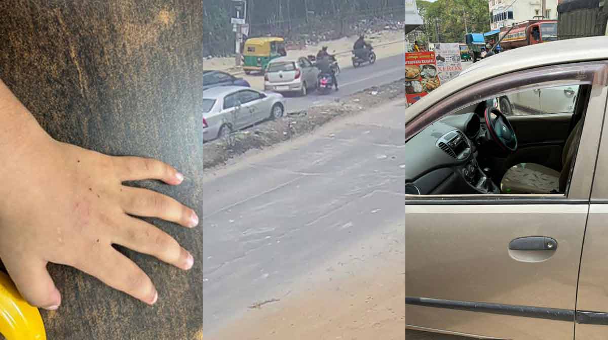 blr-family-attacked-22