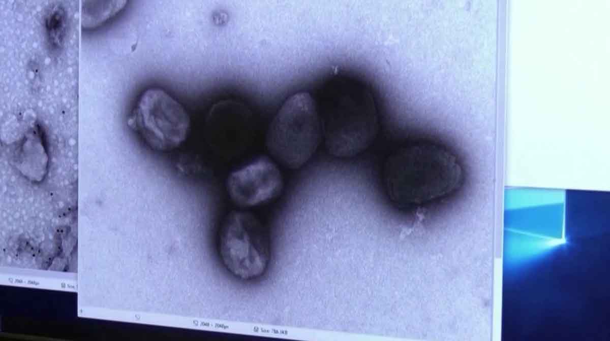 m-pox
