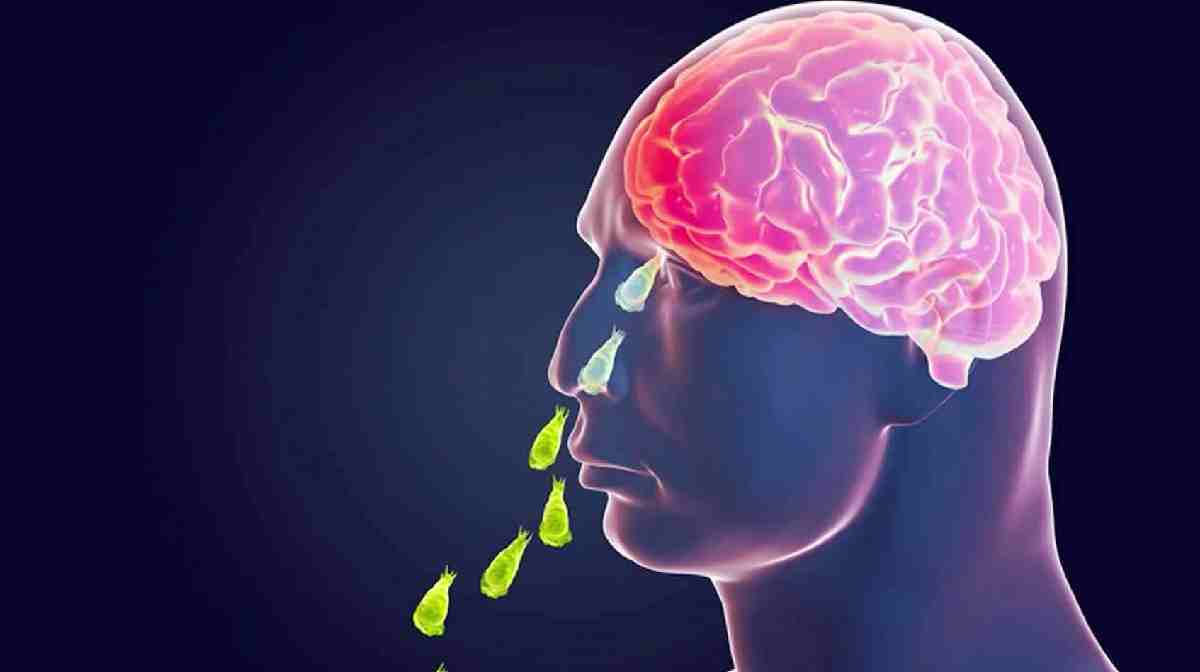 amoebic-encephalitis