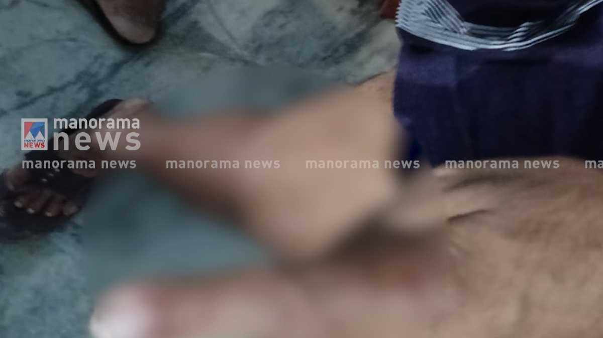 vadakara-fox-attack-injuries