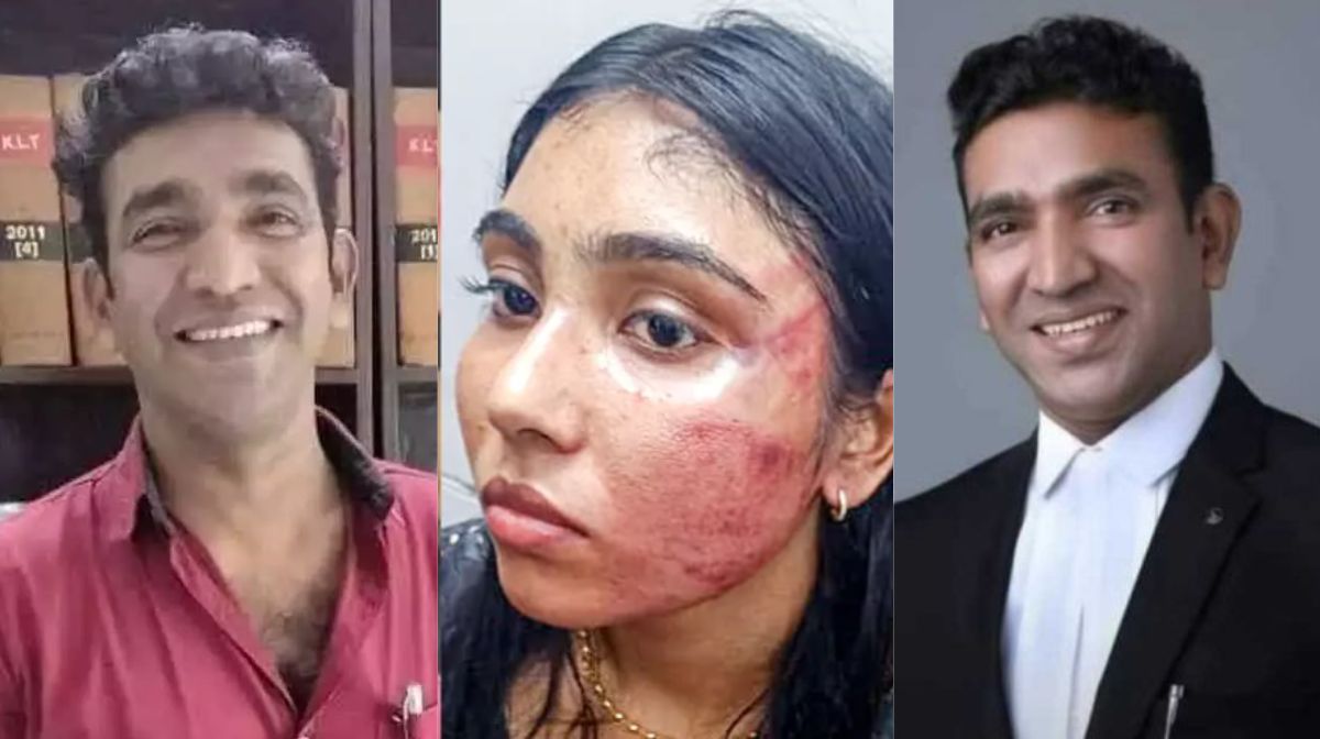 Donated kidneys, corneas, and liver - 1