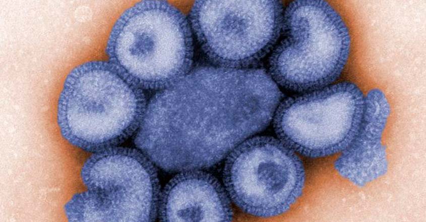 Swine Flu Swine Flu