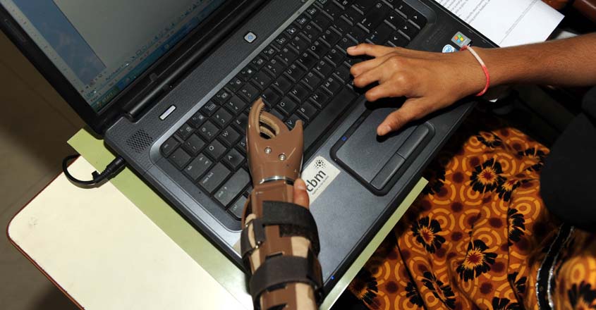 INDIA-HEALTH-PROSTHETICS INDIA-HEALTH-PROSTHETICS