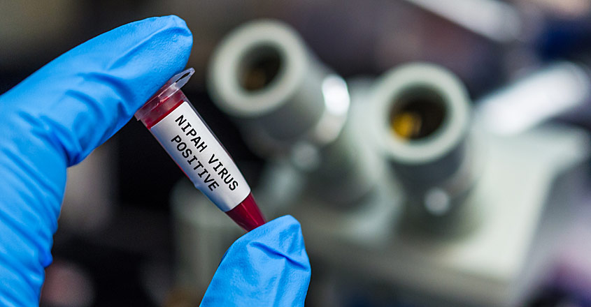 Nipah Virus
