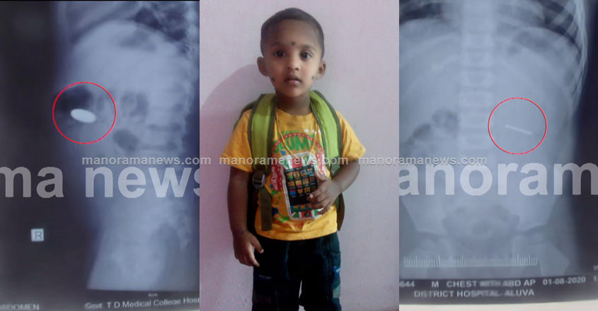 aluva-child-xray-01 aluva-child-xray-01