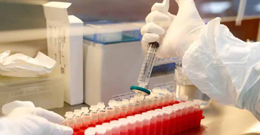 covid-vaccine-test-2 covid-vaccine-test-2