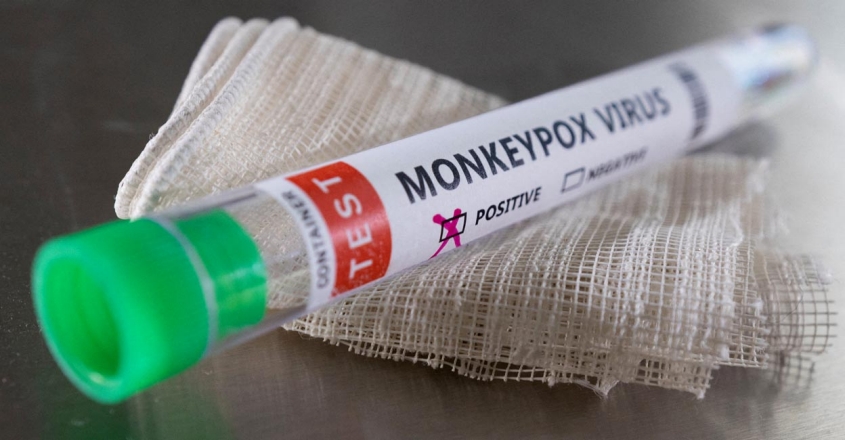 monkeypox-1-JPG-image-845-440
