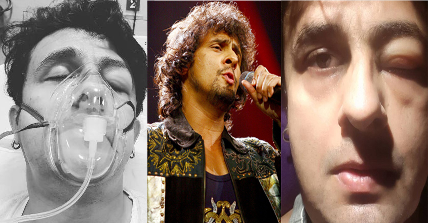 sonu-allergy sonu-allergy
