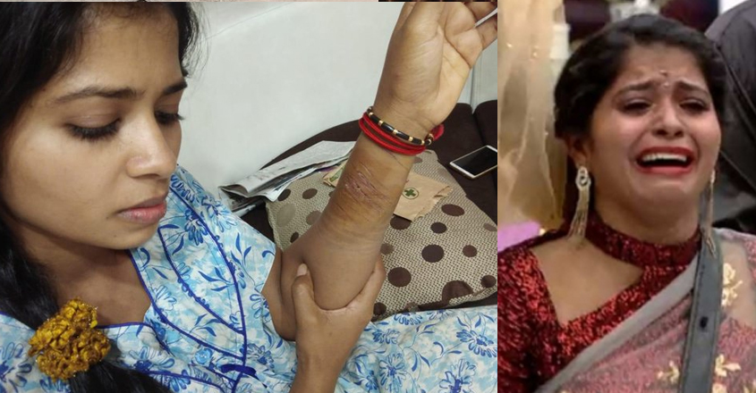 madhumitha-injury madhumitha-injury