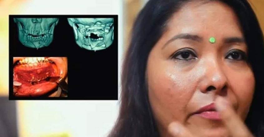 peter-hein-wife peter-hein-wife