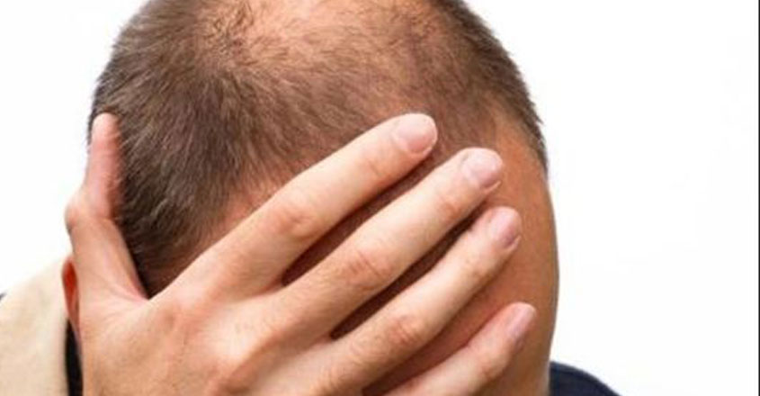 hair-transplant-15-03 hair-transplant-15-03